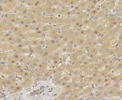 Invitrogen TNPO3 Recombinant Rabbit Monoclonal Antibody (JG38-77) 100 &mu;L;