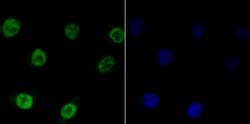 Invitrogen Bub3 Recombinant Rabbit Monoclonal Antibody (JG38-81) 100 &mu;L;