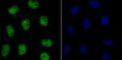 Invitrogen Bub3 Recombinant Rabbit Monoclonal Antibody (JG38-81) 100 &mu;L;
