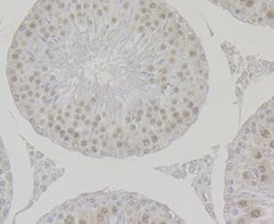 Invitrogen Bub3 Recombinant Rabbit Monoclonal Antibody (JG38-81) 100 &mu;L;