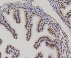 Invitrogen Bub3 Recombinant Rabbit Monoclonal Antibody (JG38-81) 100 &mu;L;
