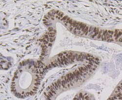 Invitrogen Bub3 Recombinant Rabbit Monoclonal Antibody (JG38-81) 100 &mu;L;