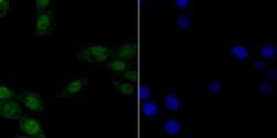 Invitrogen CAF1 p150 Recombinant Rabbit Monoclonal Antibody (JG38-98) 100