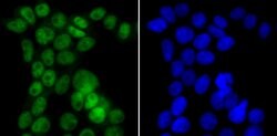 Invitrogen CAF1 p150 Recombinant Rabbit Monoclonal Antibody (JG38-98) 100