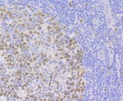 Invitrogen CAF1 p150 Recombinant Rabbit Monoclonal Antibody (JG38-98) 100