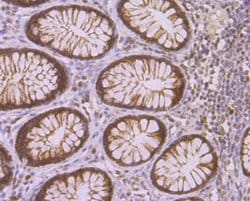 Invitrogen CAF1 p150 Recombinant Rabbit Monoclonal Antibody (JG38-98) 100