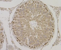 Invitrogen HYOU1 Recombinant Rabbit Monoclonal Antibody (JG39-11) 100 &mu;L;