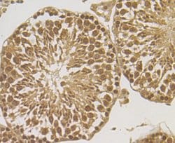 Invitrogen HYOU1 Recombinant Rabbit Monoclonal Antibody (JG39-11) 100 &mu;L;