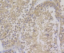 Invitrogen COMT Recombinant Rabbit Monoclonal Antibody (JG39-48) 100 &mu;L;