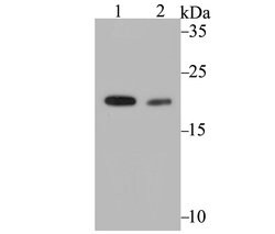 Invitrogen COMT Recombinant Rabbit Monoclonal Antibody (JG39-48) 100 &mu;L;
