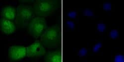 Invitrogen UNC84A Recombinant Rabbit Monoclonal Antibody (JG95-31) 100