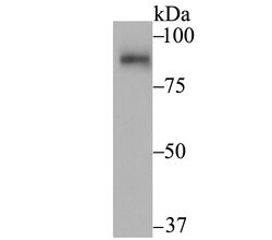 Invitrogen UNC84A Recombinant Rabbit Monoclonal Antibody (JG95-31) 100