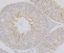 Invitrogen Nectin 2 Recombinant Rabbit Monoclonal Antibody (JG39-64) 100