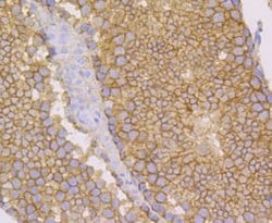 Invitrogen Nectin 2 Recombinant Rabbit Monoclonal Antibody (JG39-64) 100