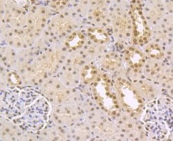 Invitrogen CtBP1 Recombinant Rabbit Monoclonal Antibody (JG39-73) 100 &mu;L;