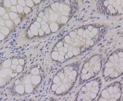 Invitrogen CtBP1 Recombinant Rabbit Monoclonal Antibody (JG39-73) 100 &mu;L;