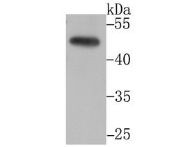 Invitrogen CtBP1 Recombinant Rabbit Monoclonal Antibody (JG39-73) 100 &mu;L;