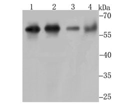 Invitrogen METAP2 Recombinant Rabbit Monoclonal Antibody (JG39-79) 100 &mu;L | Buy Online | Invitrogen&trade; | Fisher Scientific