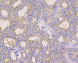 Invitrogen Monoamine Oxidase B Recombinant Rabbit Monoclonal Antibody (JG39-97)