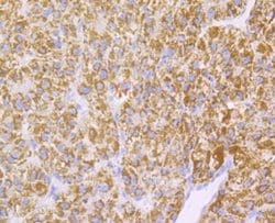Invitrogen Monoamine Oxidase B Recombinant Rabbit Monoclonal Antibody (JG39-97)