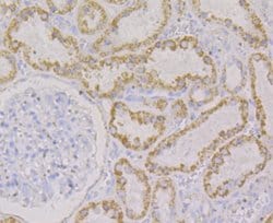 Invitrogen Monoamine Oxidase B Recombinant Rabbit Monoclonal Antibody (JG39-97)