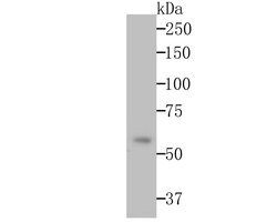 Invitrogen Monoamine Oxidase B Recombinant Rabbit Monoclonal Antibody (JG39-97)
