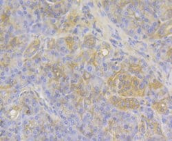 Invitrogen Mgea5 Recombinant Rabbit Monoclonal Antibody (JG40-05) 100 &mu;L;