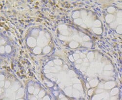 Invitrogen RACK1 Recombinant Rabbit Monoclonal Antibody (JG40-26) 100 &mu;L;