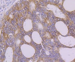 Invitrogen FAAH Recombinant Rabbit Monoclonal Antibody (JG43-07) 100 &mu;L;