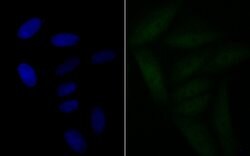 Invitrogen BRD2 Recombinant Rabbit Monoclonal Antibody (JG40-42) 100 &mu;L;