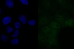 Invitrogen BRD2 Recombinant Rabbit Monoclonal Antibody (JG40-42) 100 &mu;L;