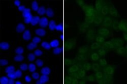 Invitrogen BRD2 Recombinant Rabbit Monoclonal Antibody (JG40-42) 100 &mu;L;
