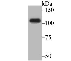 Invitrogen BRD2 Recombinant Rabbit Monoclonal Antibody (JG40-42) 100 &mu;L;