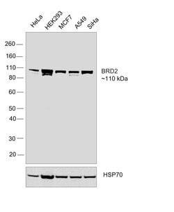 Invitrogen BRD2 Recombinant Rabbit Monoclonal Antibody (JG40-42) 100 &mu;L;