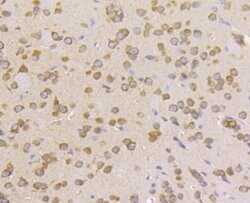 Invitrogen KARS Recombinant Rabbit Monoclonal Antibody (JE40-55) 100 &mu;L;
