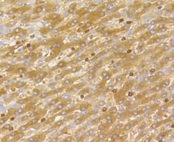 Invitrogen DIAPH1 Recombinant Rabbit Monoclonal Antibody (JE40-59) 100