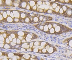 Invitrogen DIAPH1 Recombinant Rabbit Monoclonal Antibody (JE40-59) 100