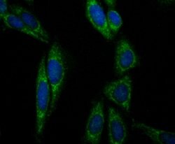 Invitrogen Aconitase 2 Recombinant Rabbit Monoclonal Antibody (JE40-83)