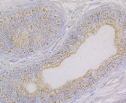 Invitrogen Aconitase 2 Recombinant Rabbit Monoclonal Antibody (JE40-83)
