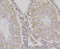 Invitrogen Aconitase 2 Recombinant Rabbit Monoclonal Antibody (JE40-83)