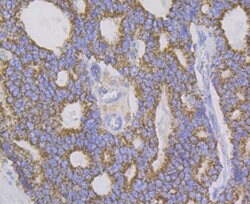 Invitrogen Aconitase 2 Recombinant Rabbit Monoclonal Antibody (JE40-83)