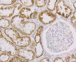 Invitrogen Aconitase 2 Recombinant Rabbit Monoclonal Antibody (JE40-83)