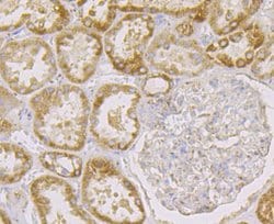 Invitrogen FIS1 Recombinant Rabbit Monoclonal Antibody (JE40-90) 100 &mu;L;
