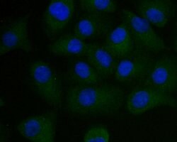 Invitrogen PEN2 Recombinant Rabbit Monoclonal Antibody (JE41-28) 100 &mu;L;