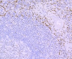 Invitrogen DDB2 Recombinant Rabbit Monoclonal Antibody (JE16-41) 100 &mu;L;