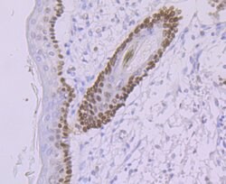 Invitrogen DDB2 Recombinant Rabbit Monoclonal Antibody (JE16-41) 100 &mu;L;