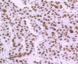 Invitrogen DDB2 Recombinant Rabbit Monoclonal Antibody (JE16-41) 100 &mu;L;