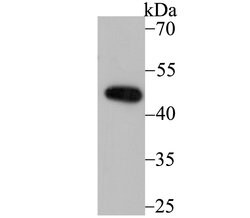 Invitrogen DDB2 Recombinant Rabbit Monoclonal Antibody (JE16-41) 100 &mu;L;