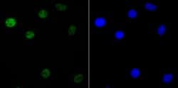 Invitrogen KHSRP Recombinant Rabbit Monoclonal Antibody (JE41-64) 100 &mu;L;