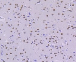 Invitrogen KHSRP Recombinant Rabbit Monoclonal Antibody (JE41-64) 100 &mu;L;